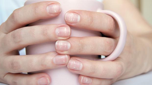 Por que salen manchas blancas en las uñas