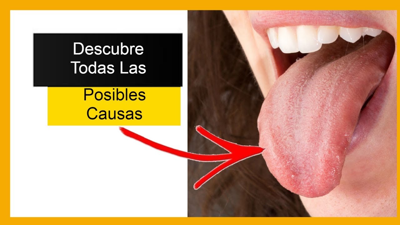 ¿Puntitos rojos en la punta de la lengua?