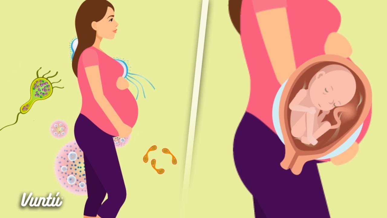 ¿Se puede comer pechuga de pavo en el embarazo?